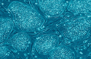 תאי גזע עובריים