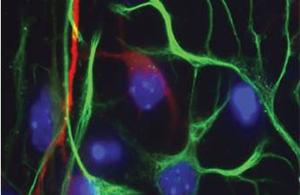 Chromatin staining