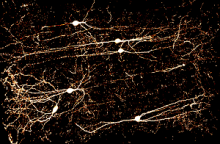  VChIs neurons