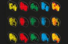 Gene expression in the brain